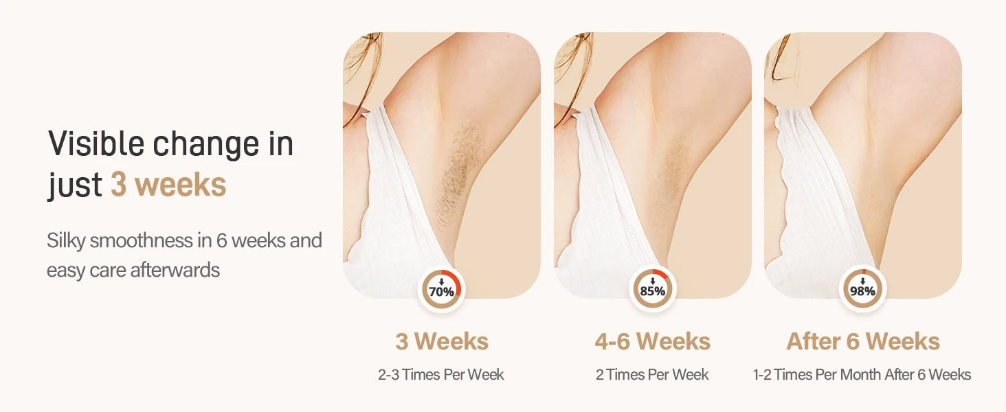 LASER HAIR REMOVER MACHINE FOR WOMEN AND MEN